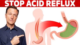 Acidity Symptoms Causes amp Treatment  Dr Srikant Mohta [upl. by Airlia]