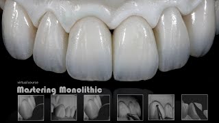 Mastering Monolithic Zirconia IN ENGLISH [upl. by Adnohsed200]