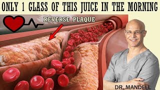 1 GLASS OF THIS JUICE IN THE MORNINGREVERSE CLOGGED ARTERIES amp LOWER HIGH BLOOD PRESSURE [upl. by Ybloc181]