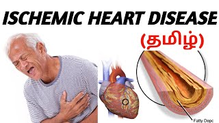 Ischemic Heart Disease  Causes  Signs and symptoms  Risk factor  Treatment  தமிழ் [upl. by Ennasus]