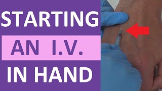 How to Start an IV  IV Catheter Insertion amp Flush Technique in Hand  Nursing Skill [upl. by Benedick]