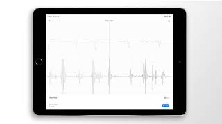 Atrial Fibrillation Combined Heart Sound PCG amp ECG Example  EkoCLINIC App [upl. by Englis797]