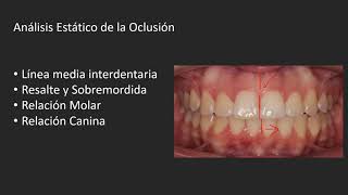 Conceptos básicos de Oclusion [upl. by Imojean862]