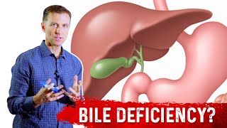 How To Know if You Have Bile Deficiency  Dr Berg [upl. by Tsiuqram177]