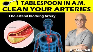 1 TABLESPOON IN AM CLEAN YOUR ARTERIES PREVENT HEART ATTACK amp STROKE  Dr Alan Mandell DC [upl. by Basir]