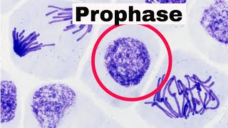 Prophase [upl. by Halle498]