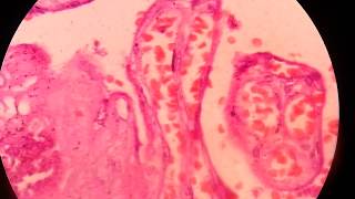 Haematoxylin and Eosin HE staining [upl. by Eahsal]