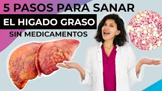 Como sanar el HÍGADO GRASO sin medicamentos Pasos para eliminar el HÍGADO GRASO de forma natural [upl. by Leirej]