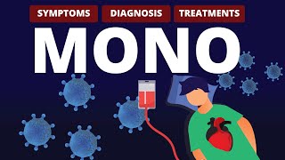 What is MONO Symptoms Diagnosis amp Treatments [upl. by Winnie]