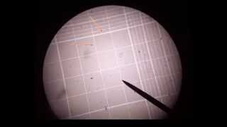 How to use a Hemocytometer [upl. by Willetta]