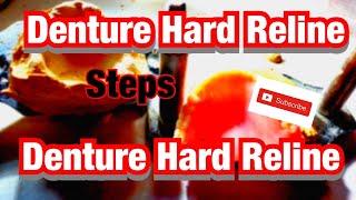 Dentures Hard Reline Instructions [upl. by Senaj]