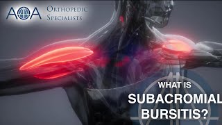 AOA Orthopedic Specialists  Subacromial Bursitis [upl. by Candie]