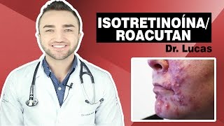 Roacutan Isotretinoína Principais Dúvidas e Efeitos Colateraiscom Dr Lucas Fustinoni [upl. by Ahsyia425]